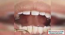 Učitajte i reproducirajte videozapise i pregledniku galerije, Ultrazvučni čistac za zube
